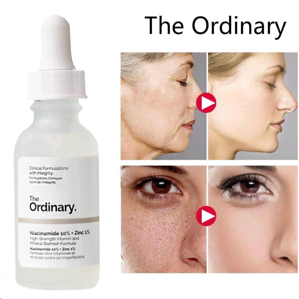 The Ordinary's Niacinamide 10% + Zinc 1% Serum