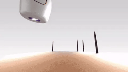 IPL Hair Remover| Laser Treatment